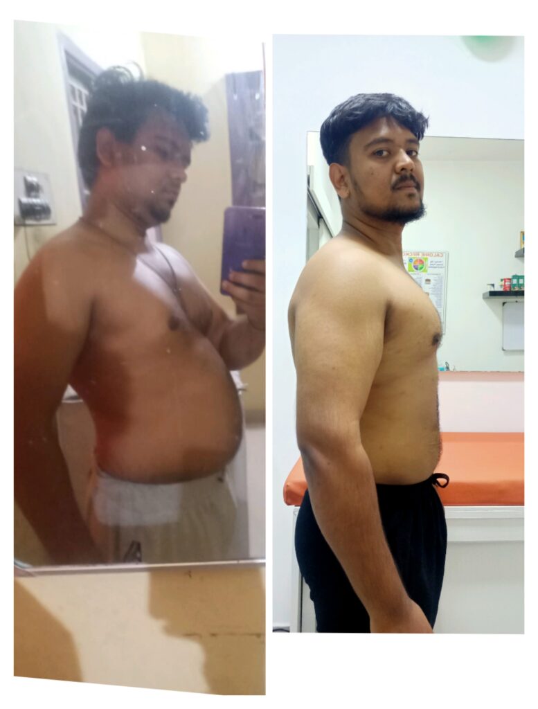 Before | After