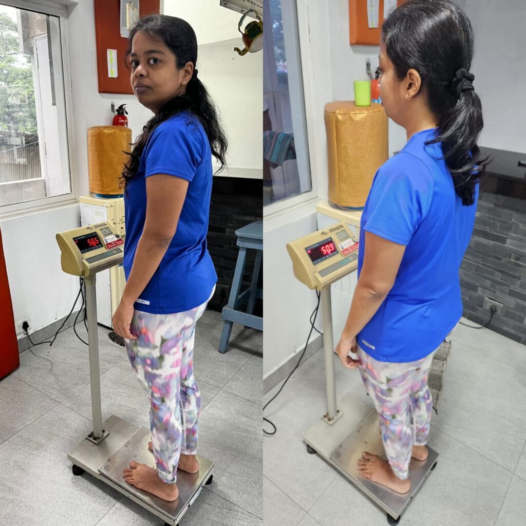 Before | After