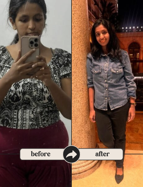 Before | After