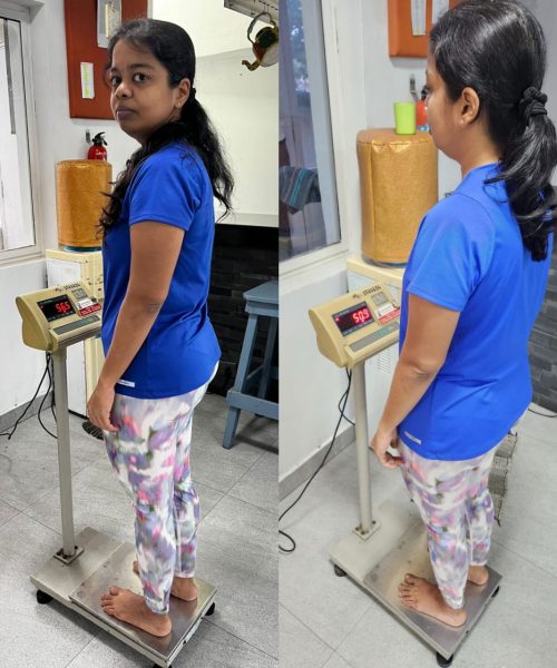 Before | After